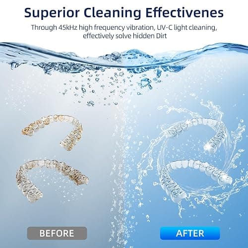 Retainer Cleaner, 45kHz Ultrasonic Retainer Cleaner Machine with 200ML Capacity & 4 Modes for Dentures, Aligners, Mouthguards, Retainers, Jewelry and Oral Appliances thumbnail 2