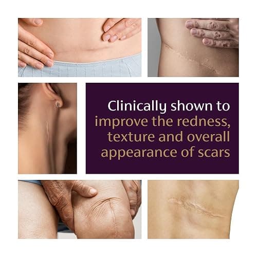 Mederma Advanced Scar Gel - Treats Old & New Scars, Reduces Appearance of Scars from Acne, Surgery, Burns, Injury & Stretch Marks, 0.70 Oz (20g) thumbnail 5