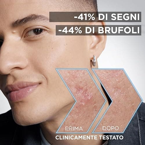 Garnier Siero Anti-imperfezioni, Per Pelle Grassa, Impura e Mista,Contrasta Punti Neri e Brufoli, Formula Vegana* con 4% [Niacinamide + AHA + BHA], Siero Pure Active AHA+BHA con Carbone, 30 ml thumbnail 2