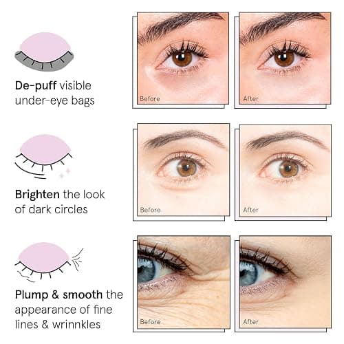 grace & stella Under Eye Patches (12 pairs) Eye Masks for Dark Circles and Puffiness - Birthday Gifts for Women, Bachelorette Party Favors, Bridesmaid Proposal Gifts, Self Care, Spa, Relaxation, Vegan thumbnail 3