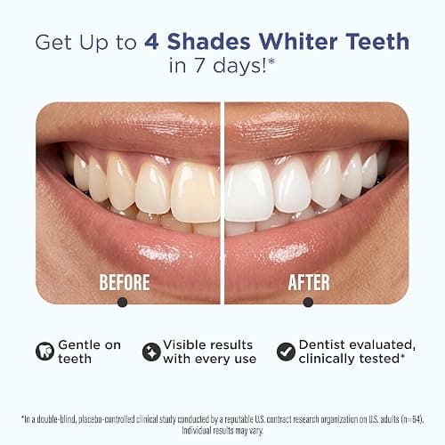GuruNanda Teeth Whitening Strips - 4X Whiter Teeth, 30-Day Whitening Kit | Non-Slip 4 Layer Dry Strip Technology|With Coconut Oil|Promotes Brighter Smile|Gentle on Enamel|Easy to Apply Teeth Whitener thumbnail 2