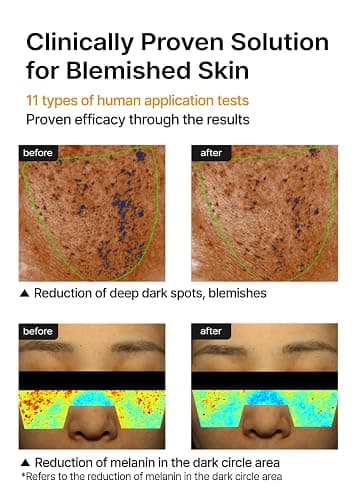 Dark Spot Cream thumbnail 5
