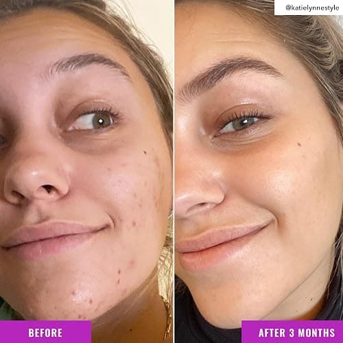Good Molecules Niacinamide Brightening Toner - Toner for Face with Niacinamide and Arbutin for Skin Tone Balancing- Pore Minimizer, Facial Skin Care thumbnail 5