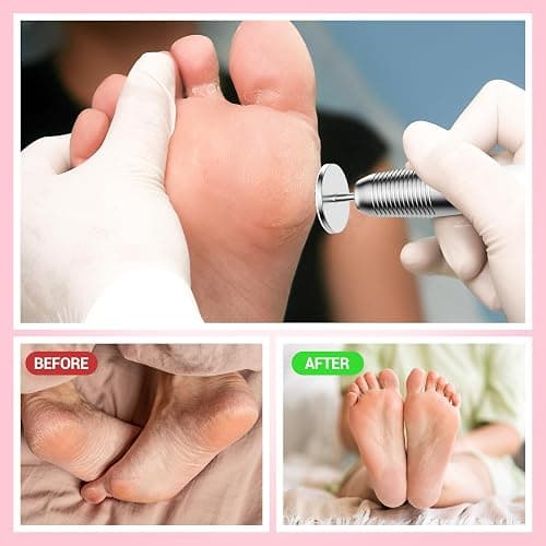 MelodySusie 60 Pcs Replacement Sandpaper Discs with 25mm Metal Nail Drill Bit, 80 Coarse 120 Medium 180 Fine Grit for Electric Foot File Callus Remover Tool or Polishing Craft thumbnail 5