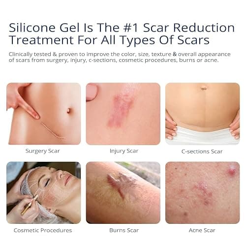 100% Silicone Scar Gel Scar Cream - Advanced Scar Gel for Surgical Scars, C-Section, Stretch Marks, Acne, Injury, Burns, Keloids, Old and New Scars 1.06oz(30g) (Maximum Strength 100% Silicone) thumbnail 2