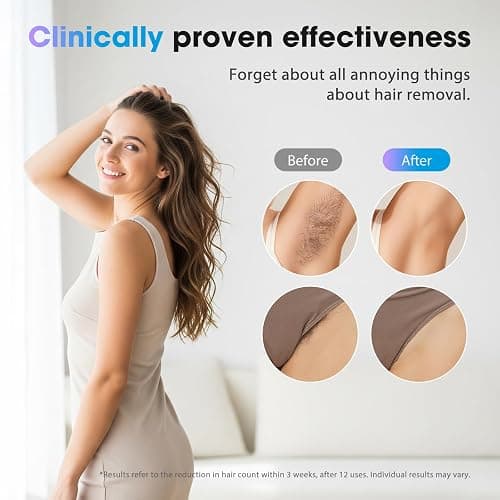 Oreeth Laser Hair Removal Device, at-Home IPL Hair Removal for Women & Men - Safe 45°F Ice-Cooling Contact for Painless & Long-Lasting Results, 86% Hair Reduction in 3 Weeks for Full Body, Gold/White thumbnail 3