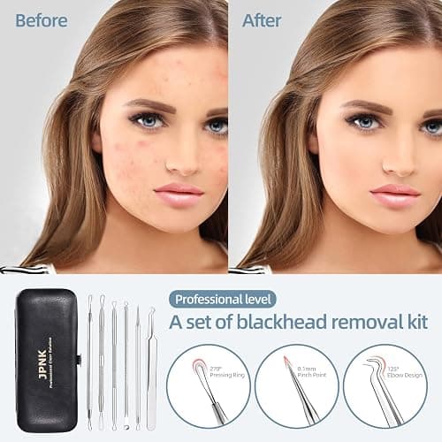 JPNK Blackhead Remover Comedone Extractor Acne Removal Kit.. thumbnail 2