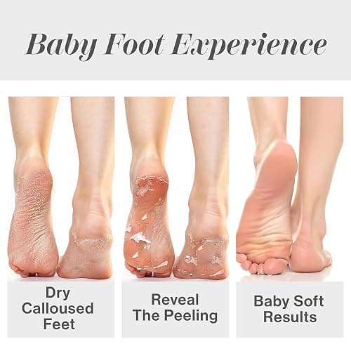 Baby Foot Original Exfoliation Foot Peel - Callus Remover for Rough Cracked, Dry Feet, Dead Skin Removal - Foot Peeling Mask for Baby Soft Feet - Spa Experience at Home & Gift Ideas - Lavender Scented thumbnail 4