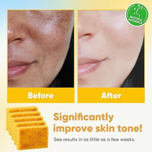 Treeroot 5 Pack Turmeric Soap for Dark Spots, 80g Kojic Acid and Turmeric Soap Bar, Face Even Skin Tone, Natural Potent Moisturizing Ingredient, Contains Vitamin C, Shea Butter, Lemon Oil, Retinol thumbnail 4