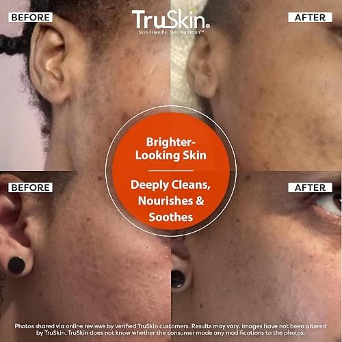TruSkin Vitamin C Brightening Face Wash with Rosehip Oil, 5 fl oz | Vitamins C & E, Aloe Vera and MSM gently cleanse, refresh and support radiant-looking skin without over-drying thumbnail 5