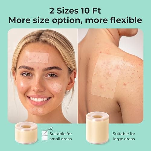 TKTK Hydrocolloid Roll 2 Sizes, Cut-to-Fit Bandages for Pimple & Wounds | 2in x 5ft + 1in x 5ft Pimple Patch Roll Value Pack, Long-Lasting, for Acne & Wounds, Easy-Peel, Waterproof, No Additives thumbnail 3