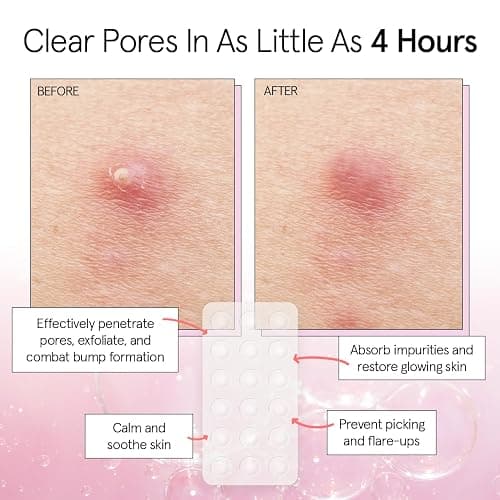 grace & stella Award Winning Invisible Skin Rescue Covers with Hydrocolloid (Round, 36 Count) - With Salicylic Acid and Tea Tree for Absorbing Impurities - Dermatologist Tested Skin Care, Cruelty Free, Vegan thumbnail 3