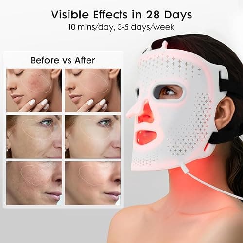 Umitec LED Face Mask Light Therapy, FDA-Cleared, 4 Modes Red Light Therapy for Face with Remote and Timer, 2000mAh Rechargeable, Blue, 850NM Infrared & Red Light Therapy Mask at Home, 288 LEDs, White thumbnail 3