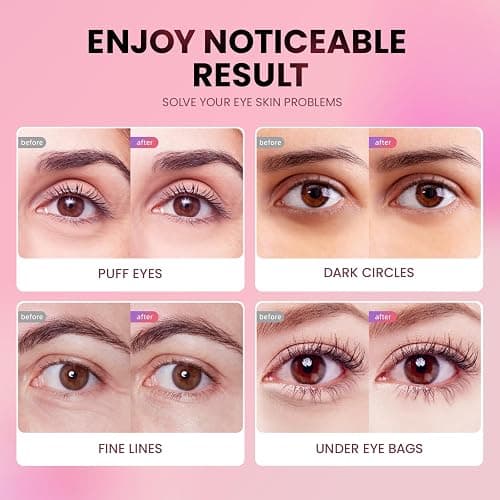 AILEORY Under Eye Patches (24 Pairs) - New Tri-color Glitter Eye Gel Pads for Dark Circles Puffy Eyes,Under eye Bags,Wrinkles|Natural Collagen Under Eye Mask Patches, Gel Under Eye Patches thumbnail 5