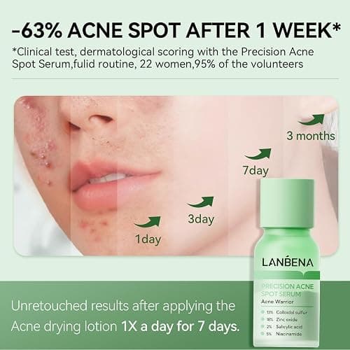 LANBENA 2% Salicylic Acid Spot Serum, 8H Rapid Acne Treatment for Acne-Prone Sensitive Skin, Fast-Acting Dry Out Pimples, Fade Acne Marks, Redness Relief, Overnight & Period Breakouts, 0.42 Fl Oz thumbnail 6