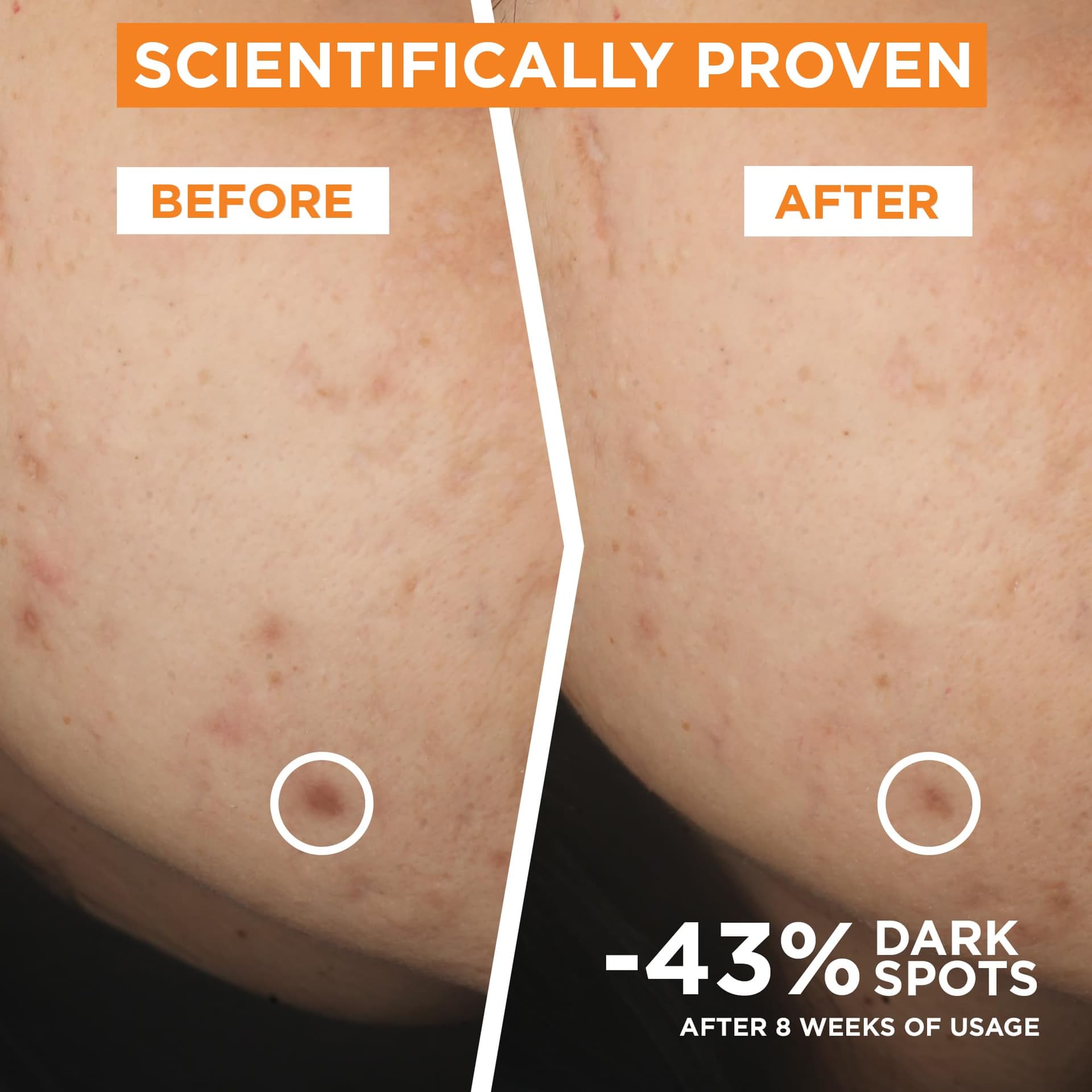Garnier Skin Active, Face Serum, Brightening & Anti-Dark Spots, 3.5% Vitamin C, 30 ml thumbnail 2
