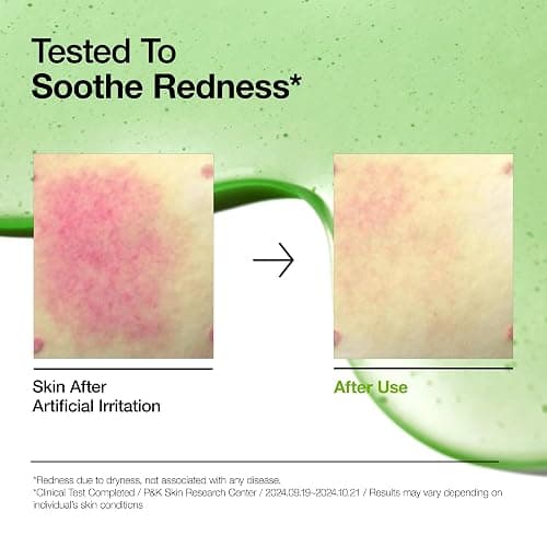 Anua Azelaic Acid 10 Hyaluron Redness Soothing Serum, Facial Serum for Troubled & Sensitive skin, Breakouts, Hyaluronic Acid, Niacinamide, Spot Care, Natural Color, Korean Skincare (30ml/ 1.01 fl oz.) thumbnail 3