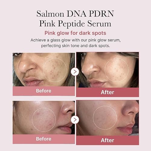 medicube Salmon DNA PDRN Pink Peptide Serum, Pink glow serum, Peptide, Niacinamide, Hydrating & Moisturizing & Firming, Uneven Skin Tone, Korean Skincare | 1.01 fl.oz. (1.01 fl.oz., Salmon DNA PDRN) thumbnail 2