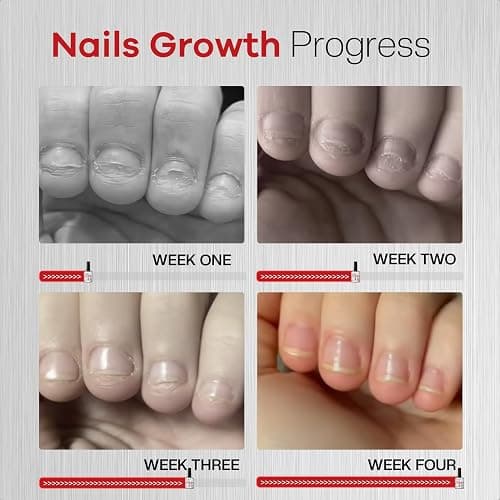 Glamonade Nail Biting Prevention Kids Extra Bitter Thumb Sucking Deterrent | 48H Long-Lasting Matte Repairs Damaged Nails Safe Habit Breaker for Nail Biting Thumb Sucking Kids Adults thumbnail 5