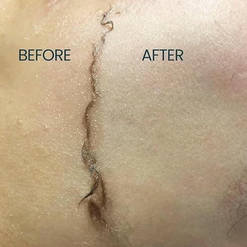 Dermaplane Oil for Women with Sensitive Skin - Face Shaving Oil - Non Comedogenic, Fragrance Free, Natural & Lightweight - Use with Dermaplane Razor for Women Face, 2oz by Ouiloe thumbnail 4