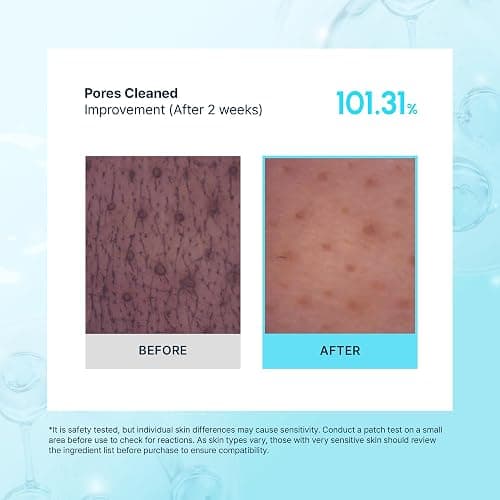 BLANC NATURE Cleansing Foam, Tea Tree Pore Deep Facial Cleanser for Oily & Sensitive Skin, Centella Asiatica, Green Tea, Korean Skincare, 5.07 fl oz (150 ml) thumbnail 5