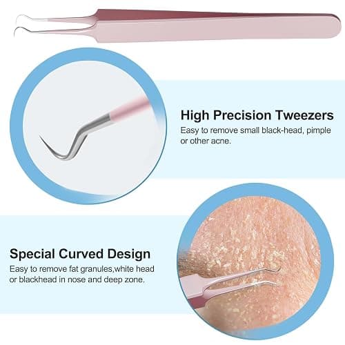 Pimple Popper Tool Kit Blackhead Remover Tools (5 Piece Kit), Professional Stainless Black Head Remover for face, Risk Free Treatment Pimple Extractor with Tweezers thumbnail 4