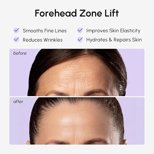 MAREE Forehead Wrinkle Patches – Collagen Wrinkle Patches with Retinol & Hyaluronic Acid for Face Lift – Fine Lines Deep Forehead Wrinkles Treatment Remover – Face Tape for Wrinkles Between Eyebrows thumbnail 3