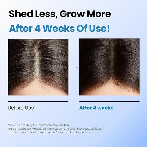 Seapuri Scalpy Hair Growth Serum for Men & Women for Hair Loss & Thinning | Scalp Treatment with Salicylic Acid, Menthol, Dexpanthenol | Non-Greasy, Lightweight | Exfoliates Dandruff & Soothes Itch thumbnail 6
