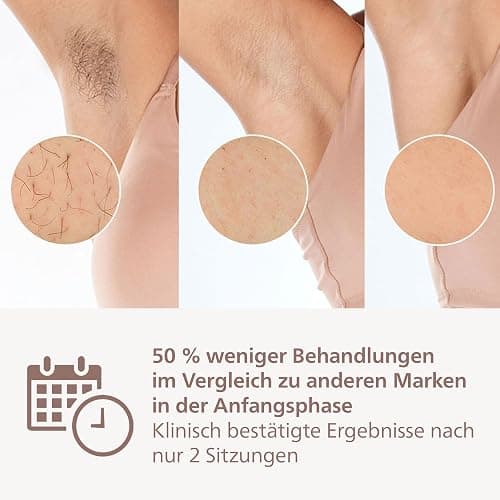 Philips Lumea IPL 7000 Series Haarentfernungsgerät – Alternative zur Laserhaarentfernung – 2 Aufsätze für Körper & Gesicht, inkl. Korrekturtrimmer (BRI921/00) thumbnail 4
