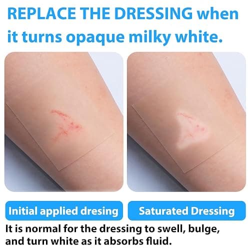 MIUXIA Hydrocolloid Roll Bandages Extra Large Pimp Patch Roll Self-Adhesive | 2in × 16ft Ultra Absorbent Flexible Latex Free Waterproof DIY Size thumbnail 5