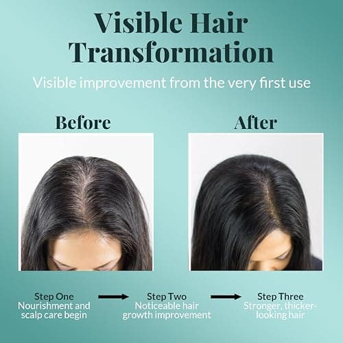 AVD Organics Rosemary Oil for Hair | Infused with Biotin | Hair Stregthening Nourishing and Volumizing | infused with Jojoba & Castor Oil | NON - GMO 120ml thumbnail 2