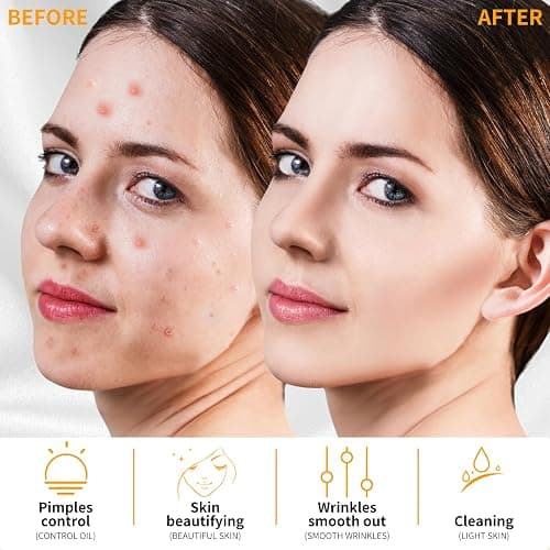 MYSWEETY High F Rrequncy Portable Handheld Facial Skin Care Wand Machine thumbnail 4