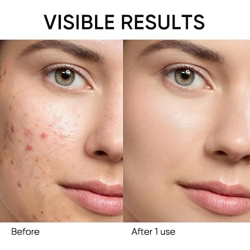 SKINTIFIC Mugwort Clay Stick Mask for Face, Redness Soothing & Breakout Control with Centella and Salicylic Acid, Gentle Exfoliating, Vegan Skincare, Wash-Off Facial Mud Mask thumbnail 4