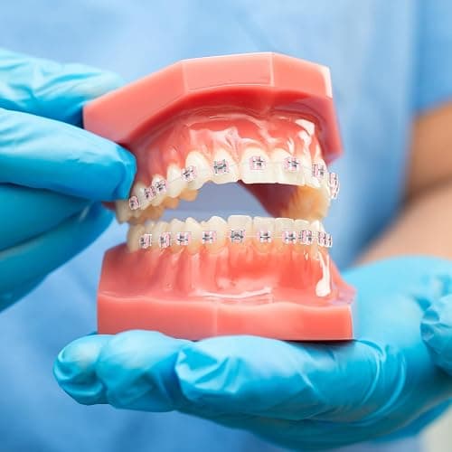 TrelaCo 1 Pack Fake Braces Artificial Tooth Decoration with Metal Wires Metal Bracket and Orthodontic Ligature Ties Practice Props for Dental Students Orthodontist Explain Props(Pink,Without Hook) thumbnail 3