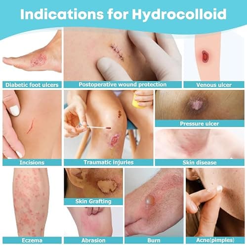 LIFARA Hydrocolloid Roll for Wound Care - Cut-to-Size, Extra Large Hydrocolloid Patch Bandages with Self-Adhesive, Ultra Absorbent, Flexible & Waterproof, First Aid Kit Essential (2in*16ft) thumbnail 3
