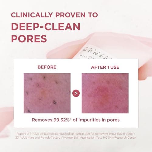 SKIN1004 Poremizing Deep Cleansing Foam, 4.23 fl.oz, 125ml, Makeup Remover, Korean Face Cleanser with Himalayan Pink Salt & Madagascar Centella Asiatica for Facial Pore Cleansing, Korean Skin Care thumbnail 3