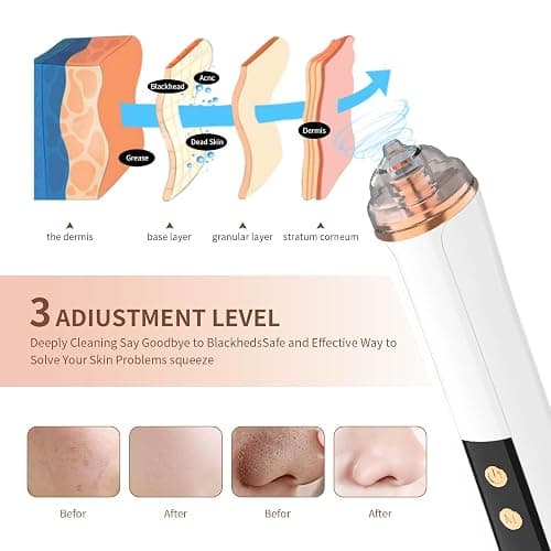 Blackhead Remover Pore Vacuum,Facial Pore Cleaner-6 Suction Power,3 Adjustable Suction Levels,USB Rechargeable Blackhead Vacuum Kit Electric Acne Extractor Tool for Women & Men (White) thumbnail 3