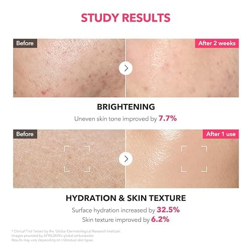 APRILSKIN TXA+Niacinamide 99 Pink Milky Toner | 99% High-Purity TXA 3%+ Niacinamide 5% for Brightening | Highly Concentrated Cream Toner | Deep Moisturizing Formula for Dull Skin | 5.07 fl.oz. thumbnail 5