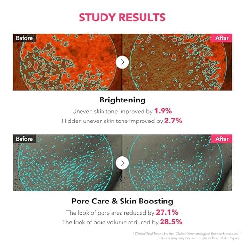 APRILSKIN TXA Niacinamide Toning Shot 99 Spicule Facial Serum｜Skin Booster Serum for Brightening and Pore Care｜99% High-Purity Tranexamic Acid 3% + Niacinamide 5%｜Korean Skin Care｜1.01 fl. oz. thumbnail 5