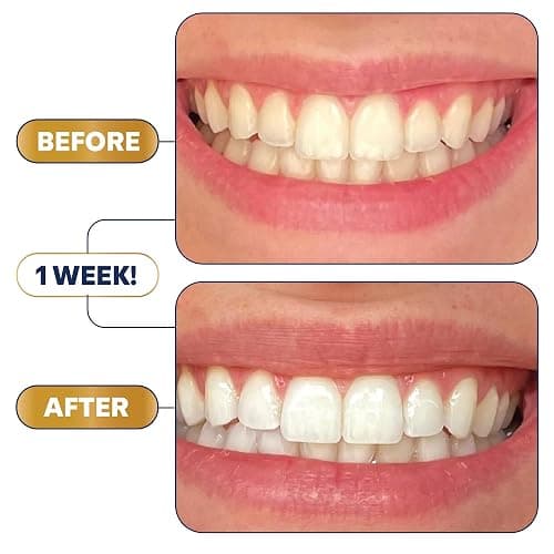Lumineux Teeth Whitening Strips - 21 Treatments - Peroxide Free - Enamel Safe for Whiter Teeth - Whitening Without The Sensitivity - Dentist Formulated - Sensitivity thumbnail 3