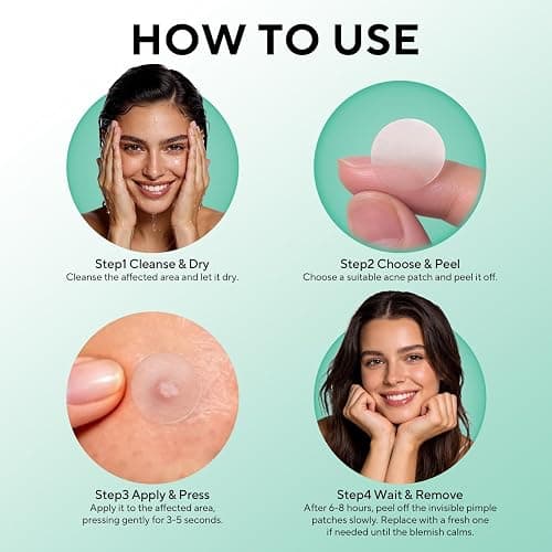 QUSTERE 580 Count Pimple Patches for Face, Large Hydrocolloid Acne Patches Stickers Bandages, Blemishes Zit Breakouts for Cheeks, Forehead, Chin, Nose for Full Face & Body | 7 Sizes | 4 Shapes thumbnail 8