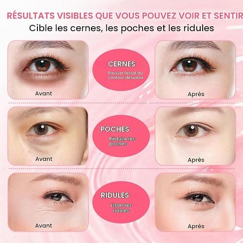 PDRN Collagen Niacinamide Under Eye Patches, Patchs pour les Yeux Hydrogel Pour Cernes, Poches, Antirides et Ridules, Soin Hydratant et Raffermissant Intense, Korean Skincare, 60 Patchs thumbnail 5