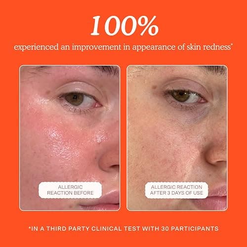 Tower 28 SOS Daily Rescue Facial Spray - Hypochlorous Acid Spray to Help Reduce Redness, Calm Irritation + Alleviate Flare-Ups - Purifying Travel Size Face Toner - Everyday Skin Care Essential (1 oz) thumbnail 3
