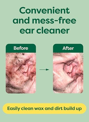 Earth Rated (A Canadian Company) Vet-Developed Pet Ear Wipes, Hypoallergenic Cleaner for Dogs & Cats Ears to Remove Dirt, Wild Oat Scent, 70 Count thumbnail 6