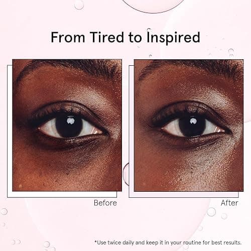 grace & stella Under Eye Brightener with Cooling Metal Rollerball - Centella Asiatica & Caffeine Eye Serum for Puffy Eyes - Travel Essentials - Under Eye Cream - Travel Essentials (15ml / 0.51floz) thumbnail 4