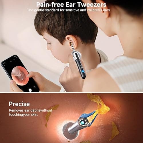 BEBIRD R1 Ultra Ear Wax Removal, Ear Cleaner with Camera Ear Scope, Wax Remove Ear Pick with Ear Otoscope Tweezers, Visual Dropper Cleaning Kit, Ear/Nose/Throat Examination Tool for Family thumbnail 5