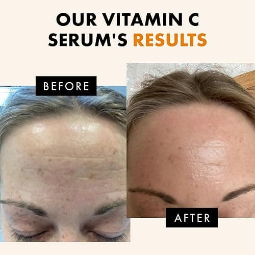 Eclat Skincare Vitamin C Face Serum - Skin Care for Dark Spots, Vitamin C Serum with Hyaluronic Acid, Ferulic Acid, & Vit E - Anti Aging and Skin Brightening, Vit C Face Care 1 Fl Oz thumbnail 4