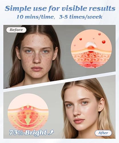EVFOFO Red Light Therapy Mask for Face, 7 Colors LED Face Mask Light Therapy At Home, Led Face Mask Light Therapy, Black thumbnail 6