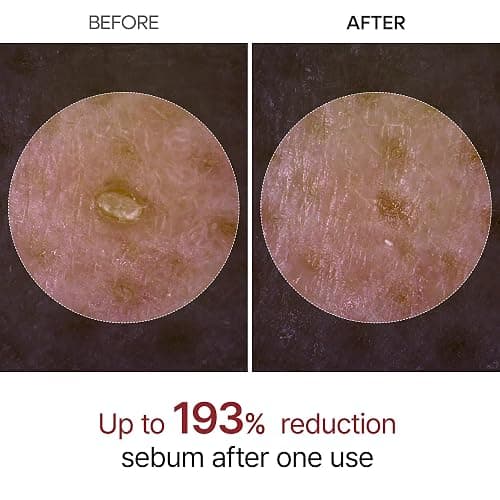 Dr.Melaxin peel shot care set black rice peeling white rice peel shot toner korean skin care cosmetics thumbnail 3
