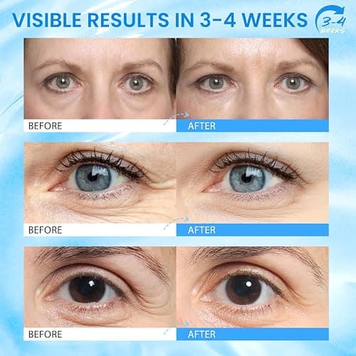 RONKIE Caffeine Eye Cream for Dark Circles: Caffeine Eye Stick - Smooth Fine Lines and Hydrate Eye Area thumbnail 3